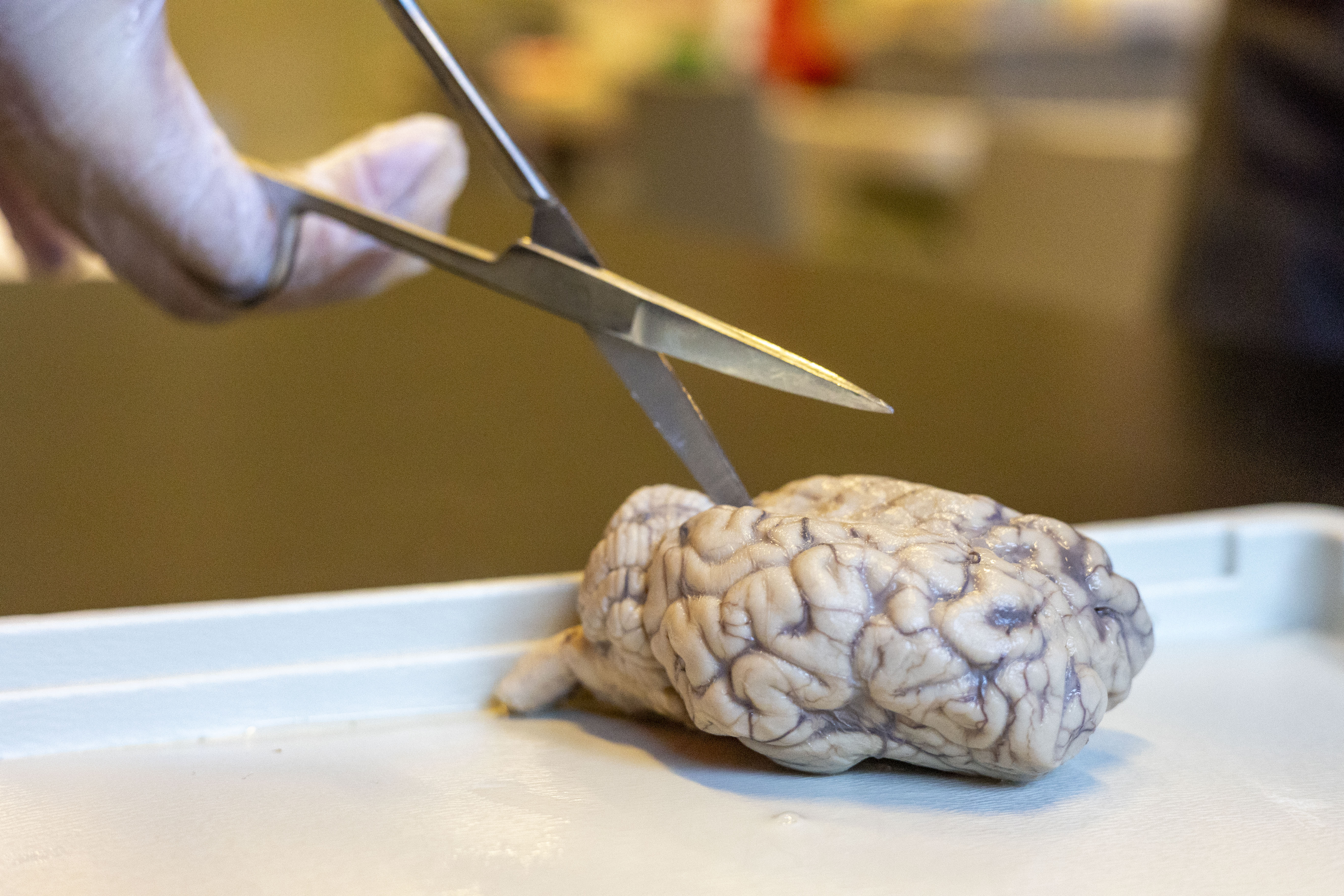 scissors cutting into brain